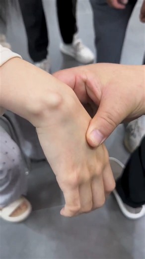 E3602 The ganglion😉🌺🤠💙cyst was instantly eliminated manually.