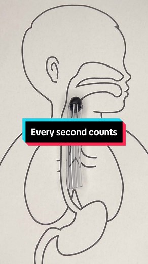 Choking First Aid Tips: Every Second Counts for Parents