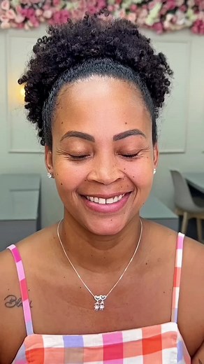 Resultado do antes e depois de um botox de resepeito! 😍 #botox