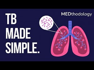 Tuberculosis Made Simple: Pathophysiology, Diagnosis, and Treatment