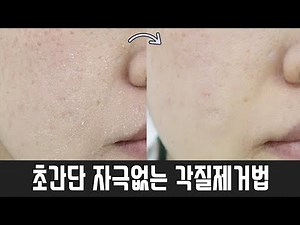 초간단 자극없이 각질제거 하는법👍🏻ㅣ닦토X,필링젤X,스크럽Xㅣ화장잘먹는법ㅣ노광고❌