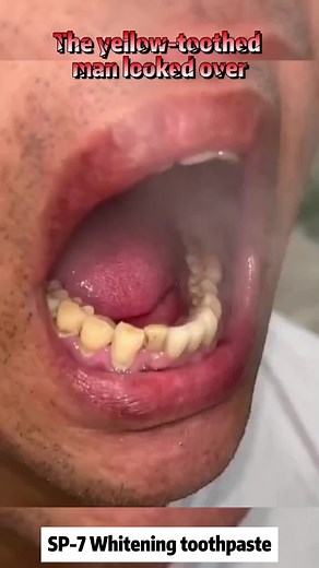 Toothpaste that helps whiten teeth!😄😄#toothpastechallenge #yellowteeth #yellowteethchallenge #teethcleaning #cleanteeth #fyp #teethcare #teeth #tiktokshop #teethwhitening