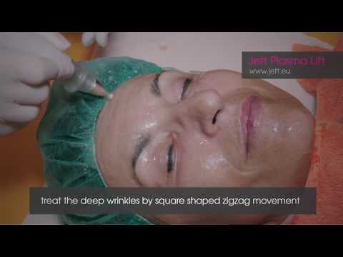 Jett Plasma Lift - face treatment