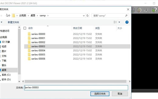 RadiAnt DICOM Viewer 医学影像浏览看图软件 安装包下载安装分享,零基础快速了解