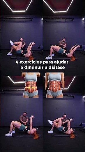 4 exercícios pra ajudar a diminuir a diástase.