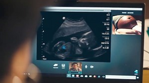 Smartphone-compatible ultrasound machine streams images from remote locations