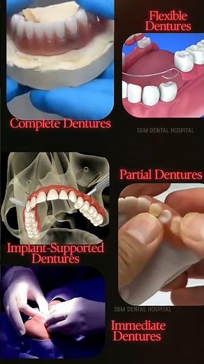 5 Different Types of Dentures Explained 🦷 | SBM Dental Kakinada