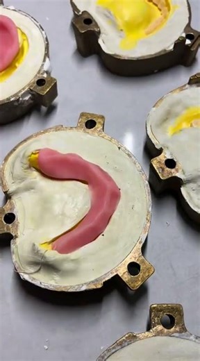 Denture making from start to finish 🦷 #dental #satisfying