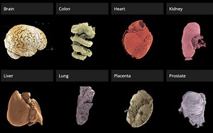 ‘Google Earth’ for human organs made available online