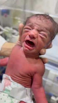Twins baby cry in humbled hands 🙌 #nicubaby #twins #premature #newbornbaby