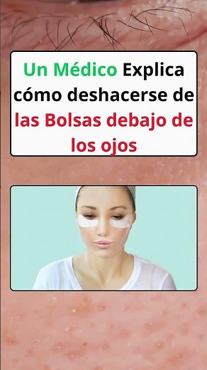 Goodbye dark circles and bags under your eyes! 👀 How to get rid of them quickly and naturally
