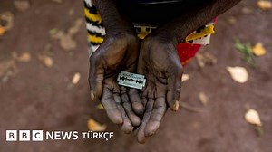 'Kadın sünneti' (genital sakatlama) nedir, hangi ülkelerde yaygın, neden durdurulamıyor? - BBC News Türkçe