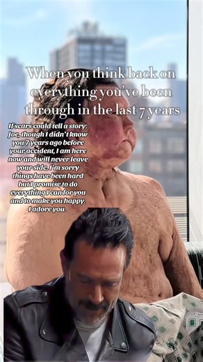 914K views · 4.8K reactions | Joe, I'm so sorry things have been hard for you. Your resilience through these times is amazing. I will never leave your side and promise to do everything I can to keep you help. | Dimeo Joe | Facebook