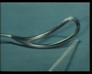 Forceps And Vacuum Delivery : PARAMEDIAVIDEO : Free Download, Borrow, and Streaming : Internet Archive