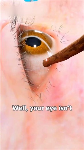 What Happens If You Damage Your Eye Accidentally Explained #science