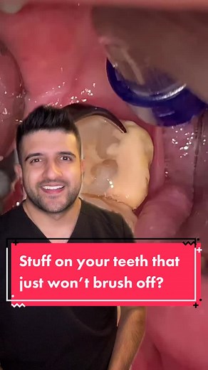 Dentist Tips for Healthy Teeth on TikTok