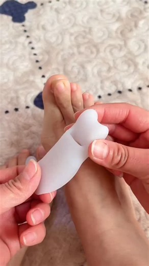 HappyToesCo | Happy feet, happy you 👣 Try the Valgus Toe Corrector today. #ToeAlignment #DailyCare #InstaTrending #ReelsContent #SmartProduct | Instagram