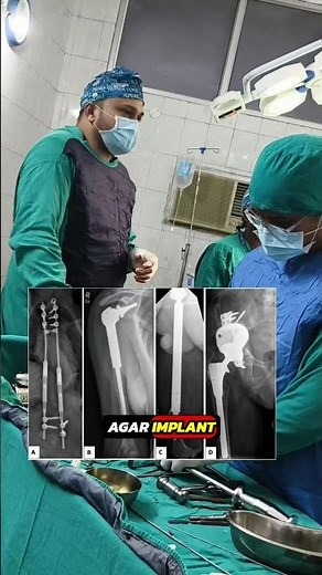 🤔Why should you choose titanium implants?