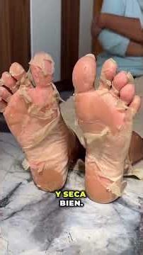 The Home Remedy Many Use for Dry Heels