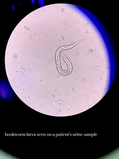Examining Parasites Under the Microscope for MedTech Students