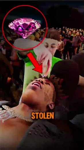 Fan RIPPED a $24 MILLION Diamond From His Forehead 😱💎