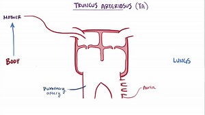 File:Truncus arteriosus video.webm - Wikimedia Commons