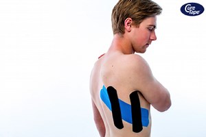 Medical Taping - gebroken of gekneusde rib | FysioTape