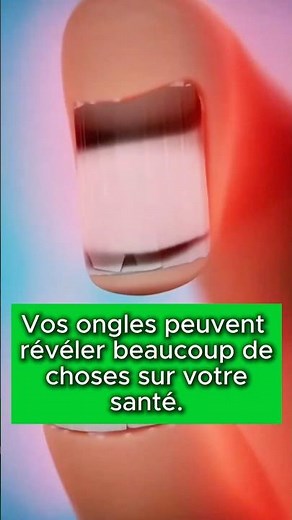 Vos ongles peuvent révéler beaucoup sur votre santé. 🤯 #bienetre #ongle #conseilssante #santé