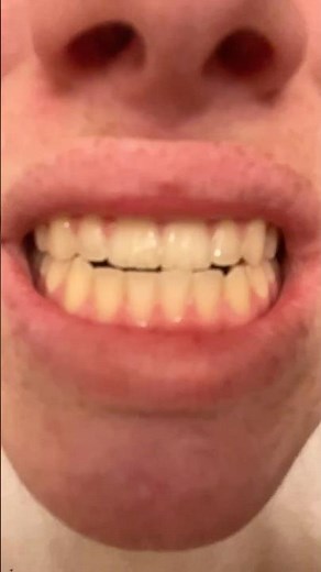 Brushing Teeth For One Hour Straight😮