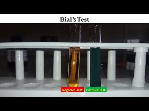 Bials Test