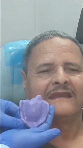 Final impression for complete denture making