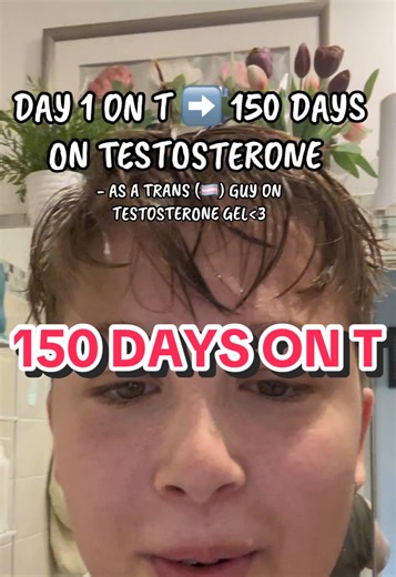 150 days on Testosterone #voiceupdateftm #ftmtransition #hrt #testosterone #fyp