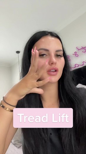 Ultimate Guide to Thread Lifts: What You Need to Know