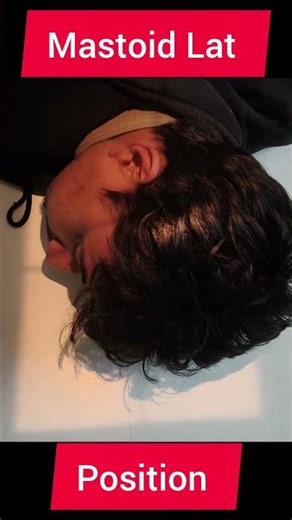 #xray #Mastoid Lat View #xraypositioning #nonfollowers #foryou