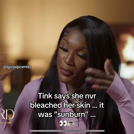 the sunburn in question..?? 👀 anyways ignore that recording error - #tinka #tinkabella #baddiesusa #baddiesmidwest #xyzbca