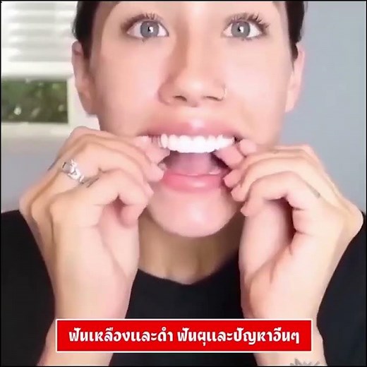Natural-Looking Silicone Dentures for Everyday Comfort