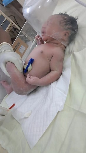 New born baby injection 💉 vit-k 1mg I'm given #fbviralpost2025シ #t2025シ #fbviralpos #hilightseveryonefollowers #babystuts #cutebaby #newbornbaby #hilights #facebook #viral | Newborn babies