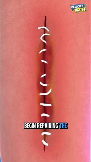 YOU Cut Your Skin… Here’s What Stitches Do
