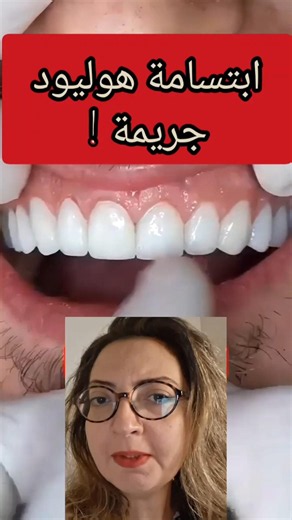 ابتسامة هوليود جريمة !