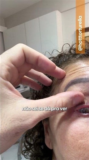 BLEFARITE - Olhos irritados todos os dias? Entenda sobre essa condição | Hott Torturella