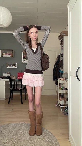 My knees are always full of bruises! But outfit is cute anyway. #outfit #spring #foryou #goviral