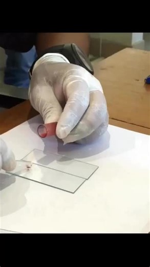 Blood Film Preparation: Techniques and Cell Morphology