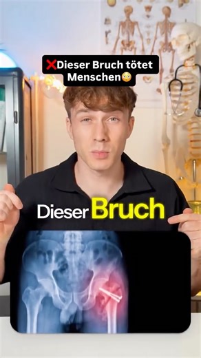 Wilhelm Ermler| Abnehmen - Gesundheit - Ernährung - Medizin on Instagram: "Teile dieses Video mit jemandem, der im Alter fit bleiben will! 💪 Wusstest du, dass ein Oberschenkelhalsbruch in 25 % der Fälle tödlich endet – und trotzdem oft vermeidbar ist? 😳 👉 Die Rede ist vom stillen Killer im Alter: dem Oberschenkelhalsbruch. Doch warum passiert das so häufig? Im Alter verlieren wir jedes Jahr etwa 1 % unserer Muskelmasse. Gleichzeitig steigt das Risiko für Osteoporose. 💥 Weniger Muskeln = schl