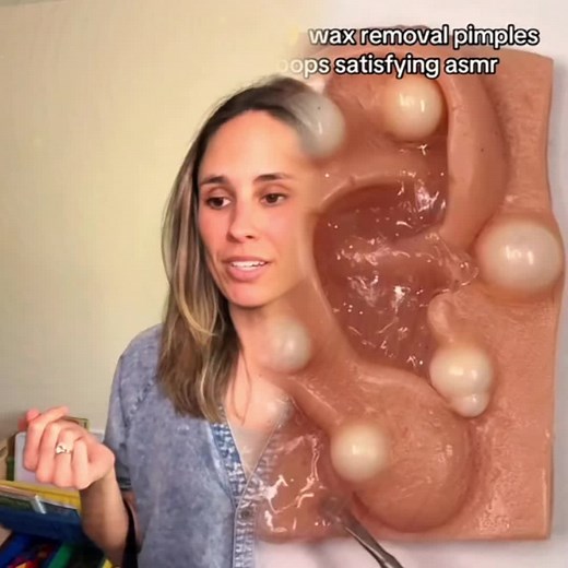 Watch relax and clear your mind a bit #pimplepopperaddict #pimple #extractions #ingrownhairremoval #ingrown #ingrownhair #picking #tweezers #skinpicking #satisfying #blemishes #blemishbandits #cloggedpores #pores #acne #hair #cleanskincare #skincareroutine #fyp #relaxingvideos #viral #trending #viraltiktok #creatorsearchinsights#foryou#tiktok#pvo#skitru