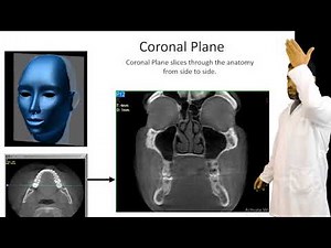 principles of CBCT and its clinical use