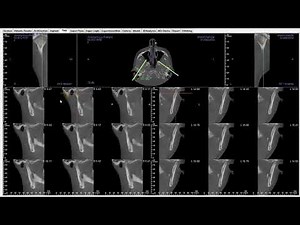 Invivo™ 5 Training Series: TMJ Tab - Setup