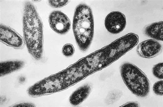 Legionnaires' - A Recent Outbreak, and New Insights | Microbiology