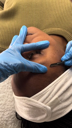 I really Love it when yall work from “home”… Use that hour break for your facials bathong🤭 Here’s the full procedure of a chemical peel plus dermaplanning…#chemicalpeel #dermaplaning #viral #fyp #explore #explorepage #pretoriatiktok #radiantskin #winterskincare #hydratedskin #footmassage #skinsomaaesthetics #workingfromhome #bushfire preps #glowingskin #evenskintone #healthylifestyle #aesthetics #aesthetician #medicalaesthetics #dermalaesthetics #somatologist