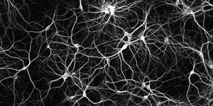 Le cerveau Haut Potentiel Intellectuel : une réalité neuro-physiologique - Margerie Véron