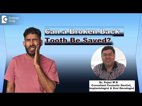 How to Repair a Tooth Broken in Half? - Dr. Pujari M R | Doctors' Circle